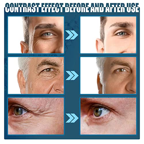 Férfi frissítő, gyengéd szemránckrém, anti-aging eye cream, csökkenti a szem finom vonalak, javítja a szem táskák, sötét